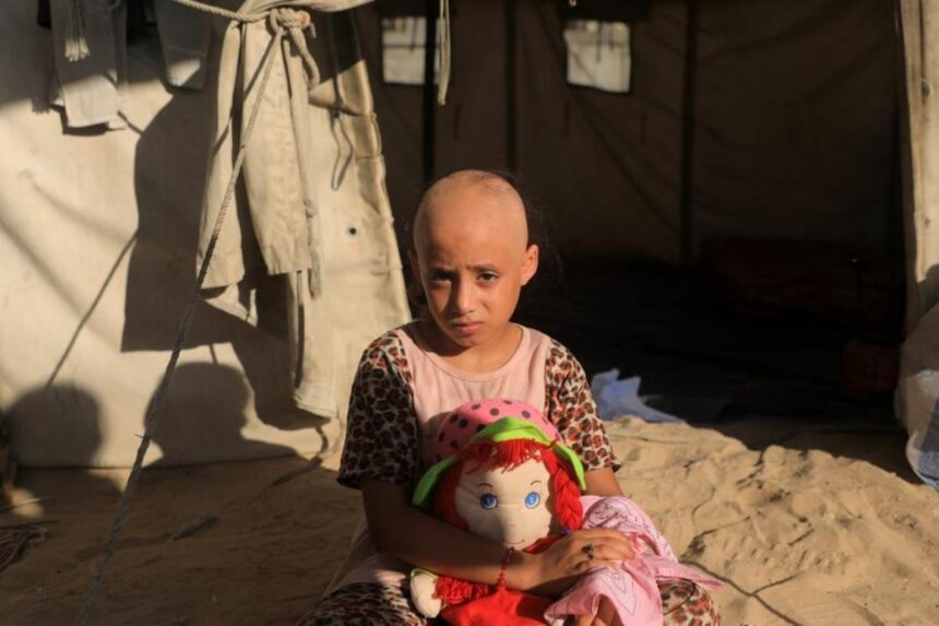 Criança perde o cabelo por choque nervoso provocado por guerra em Gaza